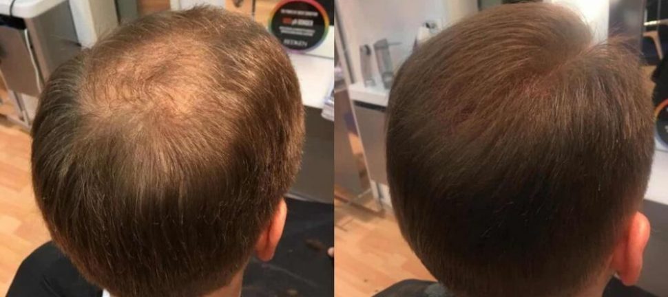 Parykk  en praktisk guide til valg, bruk og stell
